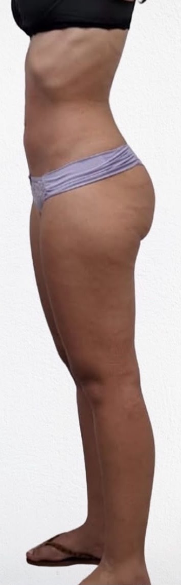 second image